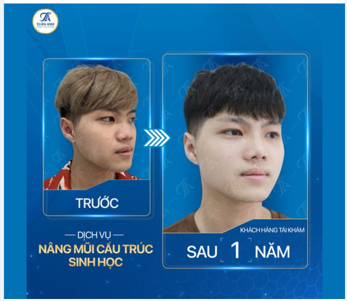 LẤY LẠI SỰ TỰ TIN CHO HOT BOY 2K3 TRƯỜNG KINH TẾ QUỐC DÂN