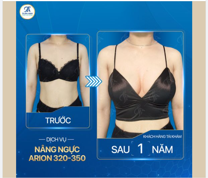 VÒNG 1 ĐẸP HƠN, HẠNH PHÚC HƠN