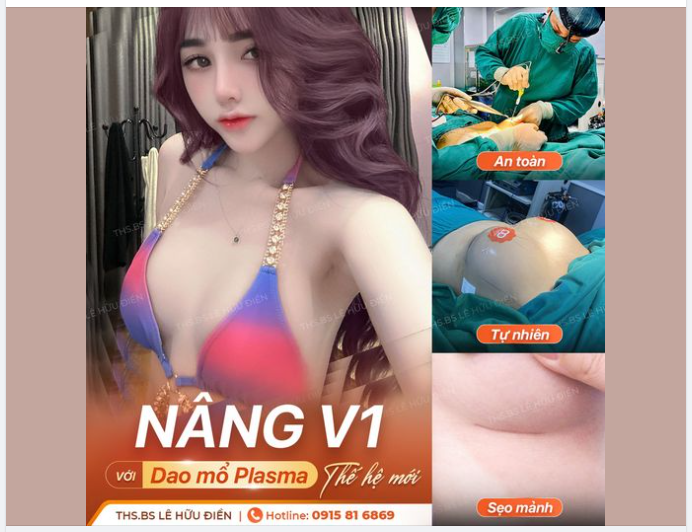 NGỰC ĐẸP MÊ LY - CHỈ SAU 2 NGÀY Công nghệ Nâng V1 với DAO MỔ PLASMA "thế hệ mới"