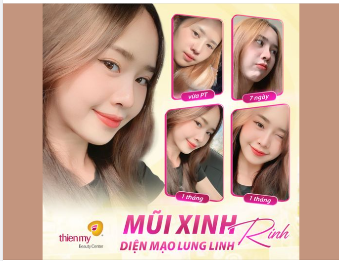 Mũi cao thanh thoát - Toát lên thần thái