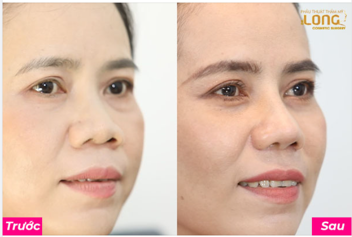 THỨC DẬY VỚI DÁNG MŨI KỲ LẠ LÀ CẢM GIÁC NHƯ THẾ NÀO?