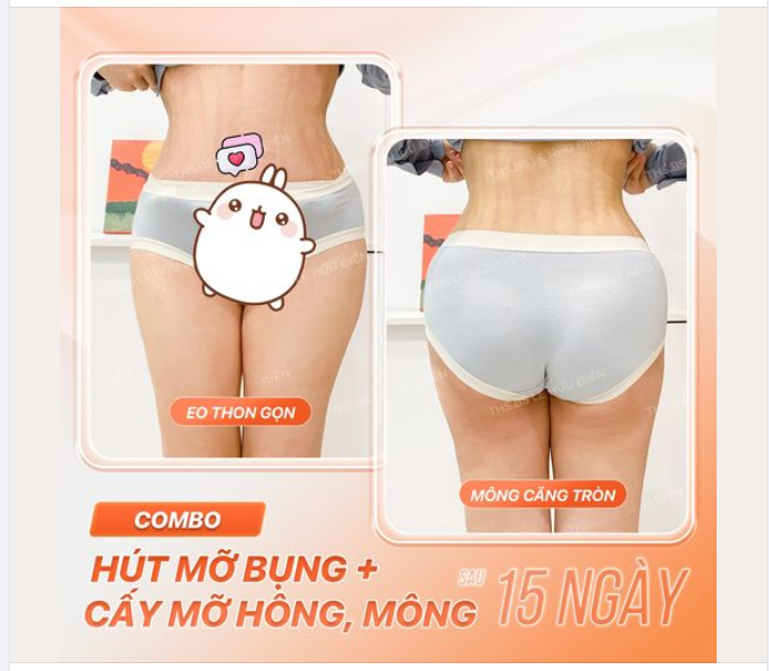 Muốn hông nở, eo thon mà không cần đến phòng tập.