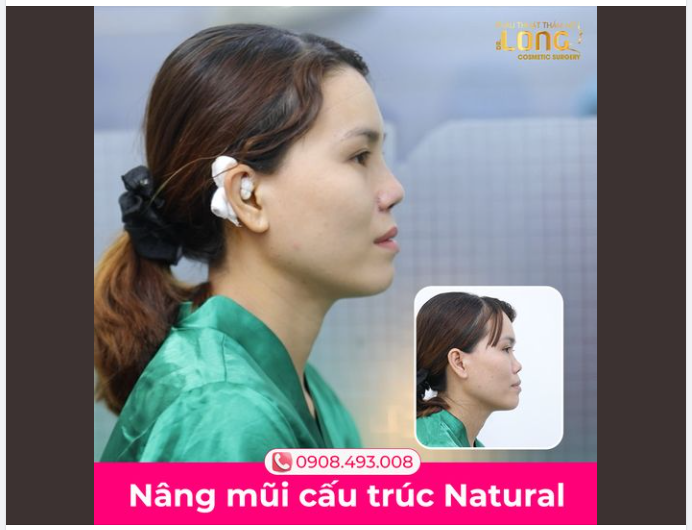 MŨI CẤU TRÚC KẾT THÚC CHUỖI NGÀY “TỰ TI”