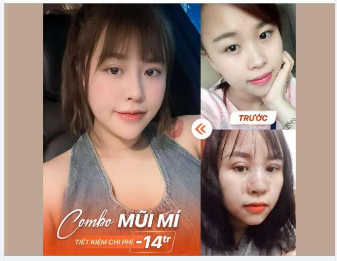 COMBO MŨI MÍ, TIẾT KIỆM CHI PHÍ ĐẾN 14TR
