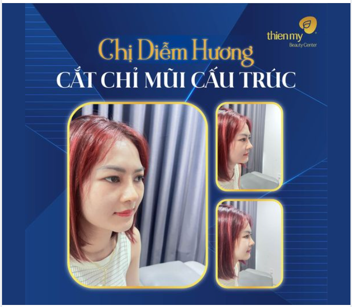 Không phải lần đầu tiên nhận được feedback nâng mũi cắt chỉ mũi cấu trúc của khách hàng nhưng thật sự rất trân trọng và hạnh phúc khi mang lại chiếc mũi đẹp tự nhiên giúp khách hàng xinh đẹp và tự tin nhất