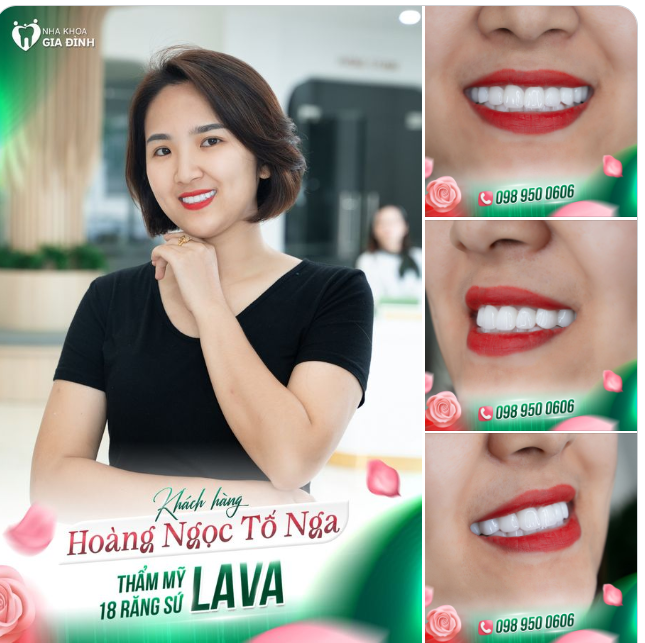 KHOẢNG CÁCH CHẠM TỚI NỤ CƯỜI HẠNH PHÚC LÀ BAO XA?