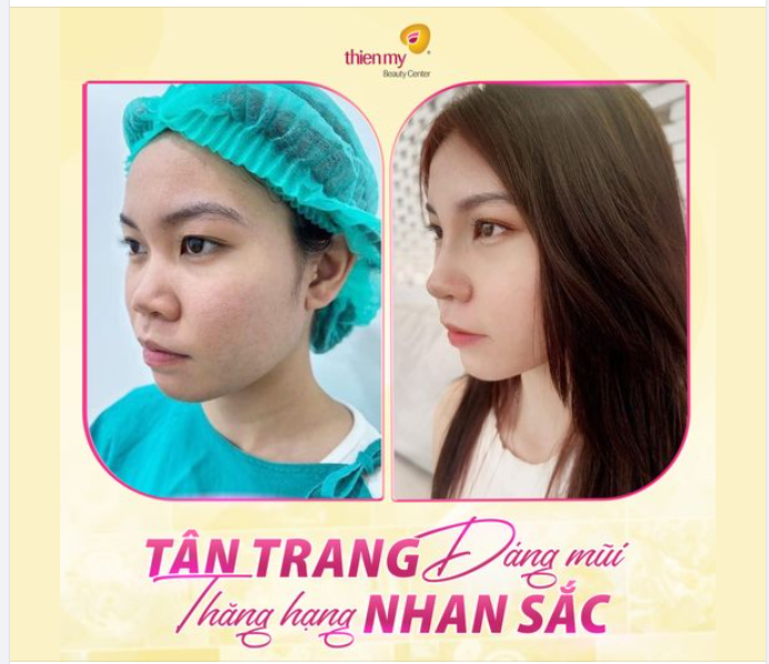 Chỉ đơn giản là thay dáng mũi thôi mà chị khách xinh ơi là xinh!