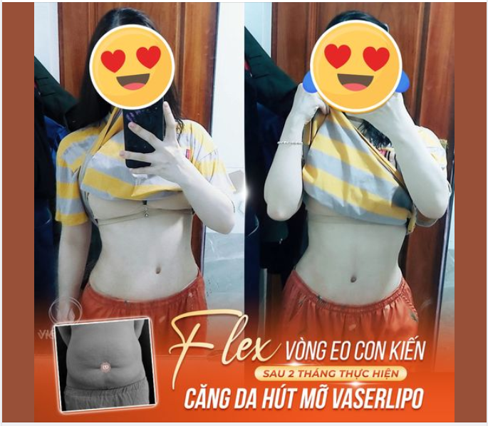 GIẢM MỠ "THẦN TỐC" - CÓ NGAY EO "MI NHON"
