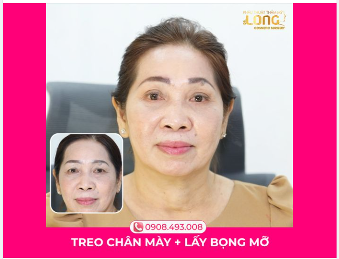 AI CŨNG KHEN “TRẺ” DÙ ĐÃ HƠN 50 TUỔI VÀ ĐÂY LÀ LÝ DO
