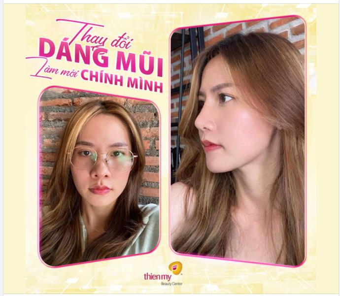 CÓ LỜI ĐỒN: Bác sĩ VTM Thiện Mỹ "Sửa mũi mát tay lắm"?!!