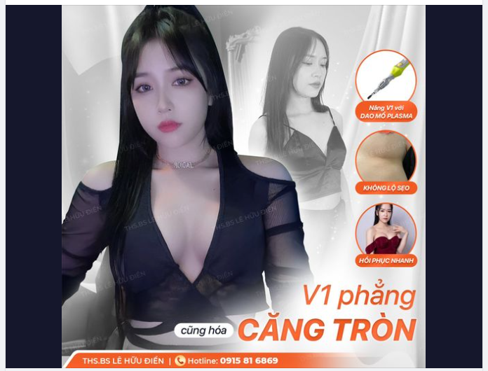 V1 PHẲNG CŨNG HOÁ CĂNG TRÒN