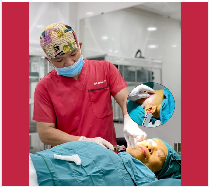 MỠ MÁ ĐƯỢC CẤY BÊN TRONG HAY BÊN NGOÀI?