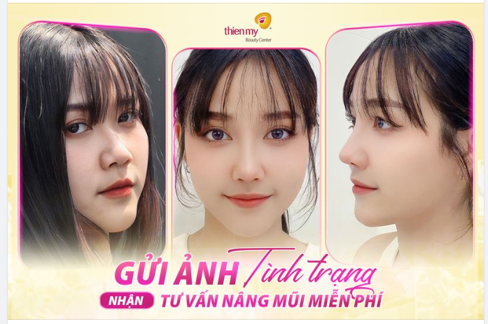 “Em muốn chiếc mũi mình cao thon, hợp gương mặt ạ!” Và đây là cái kết: