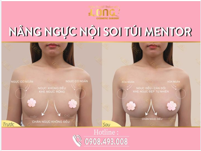 VÒNG 1 “0 ĐIỂM” - KHÔNG CÓ ĐIỂM NÀO CHÊ