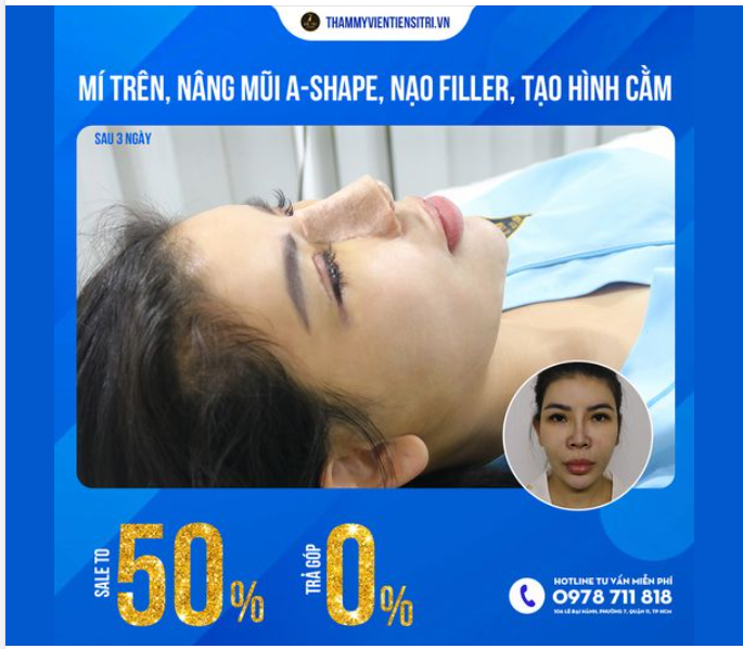 THÁNG CỦA PHÁP ĐẸP! DR.TRÍ TẶNG ƯU ĐÃI HOT!!!
