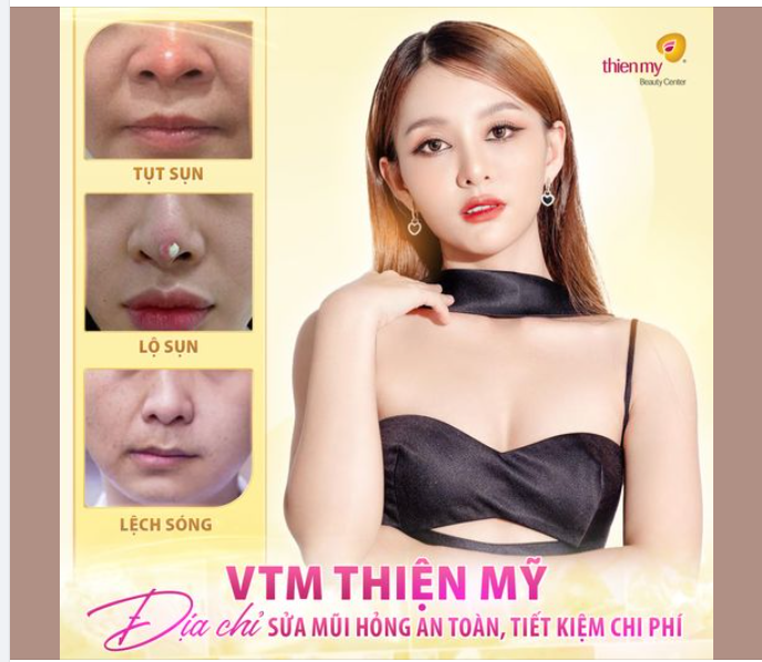 “Bác sĩ ơi! Em từng nâng mũi ở nơi khác nhưng giờ mũi em bị lệch có khắc phục được không ạ?”