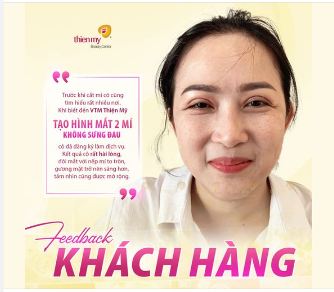 Trải nghiệm “chân thật” từ khách hàng đã thực hiện dịch vụ cắt mí tại Thiện Mỹ
