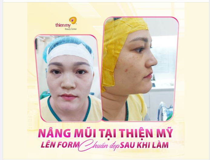 Lên feedback cho KH có động lực làm đẹp nè!