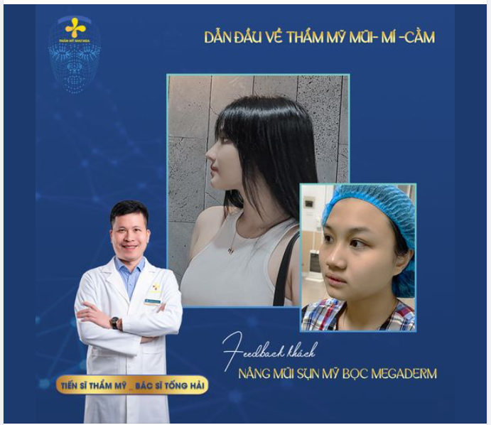 MŨI ĐẸP TỰ NHIÊN – TỰ TIN SELFIE