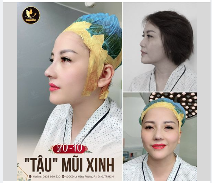20-10  “TẬU” MŨI XINH TẠI DR. HOẠT