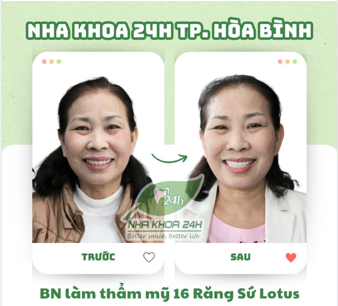 NỤ CƯỜI RẠNG RỠ