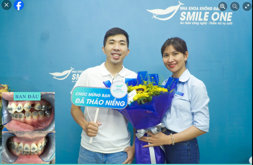 Chúc mừng Anh Phạm Tuấn Ninh đã về đích xuất sắc trên hành trình niềng răng của mình!