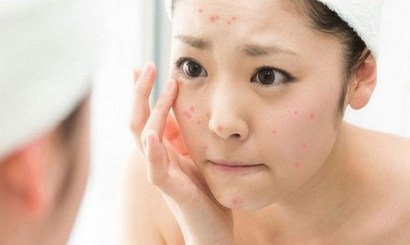 tac dung thuoc doxycycline