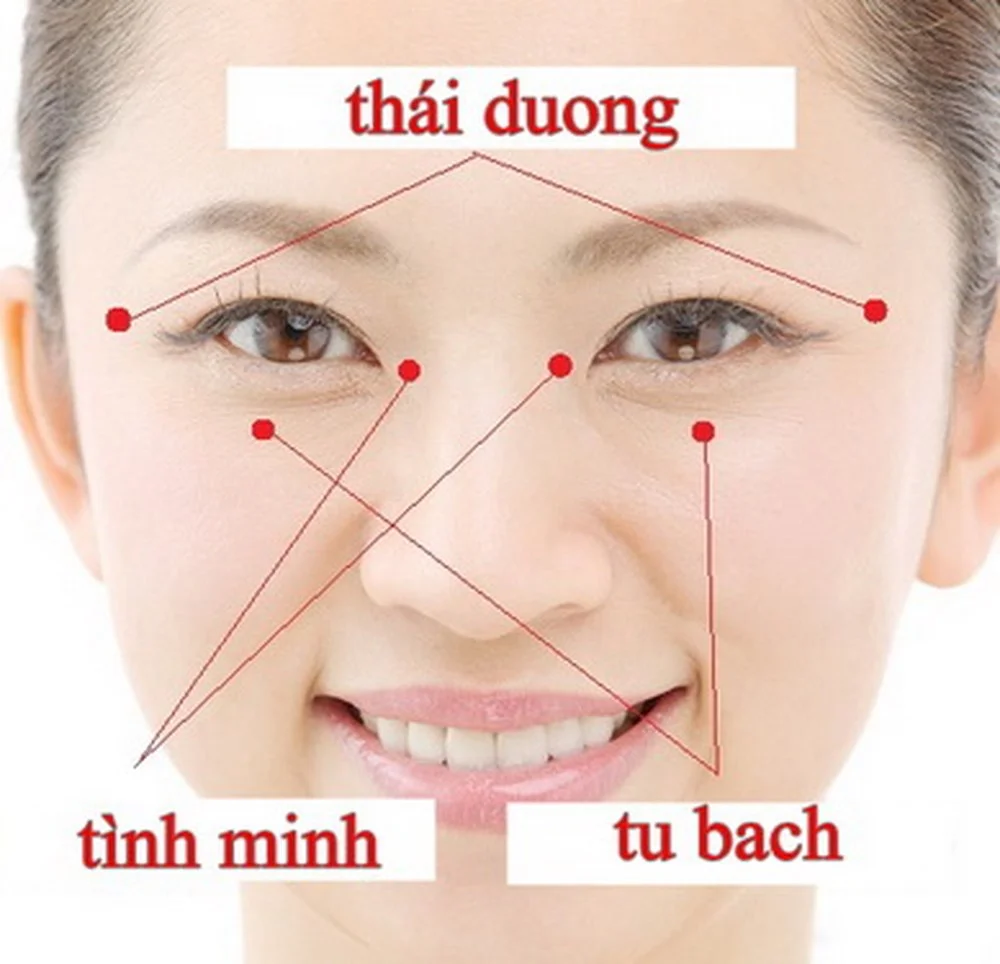 Tiêm filler thái dương là gì? Giá bao nhiêu? Có an toàn không? 