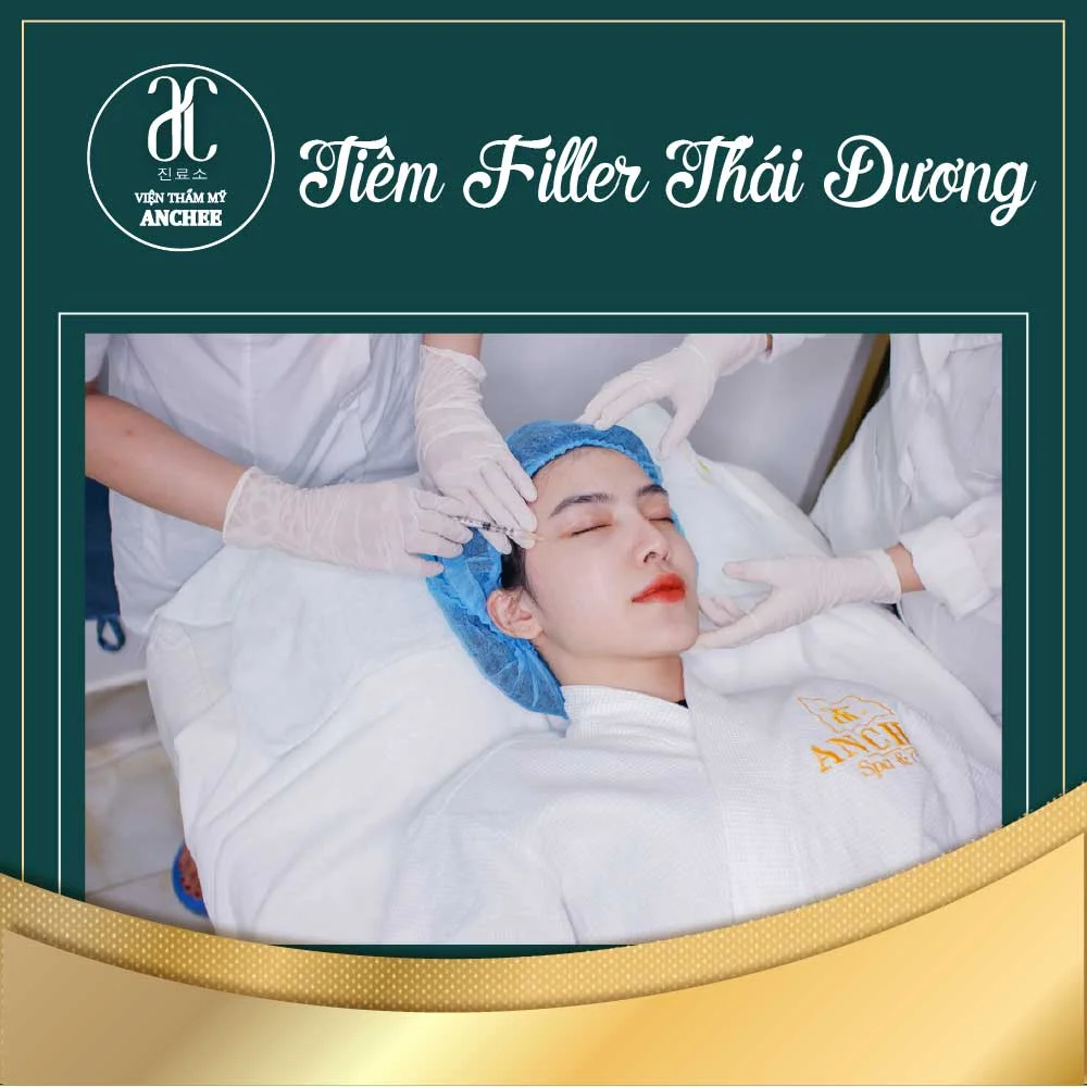 tiem-filler-thai-duong-la-gi