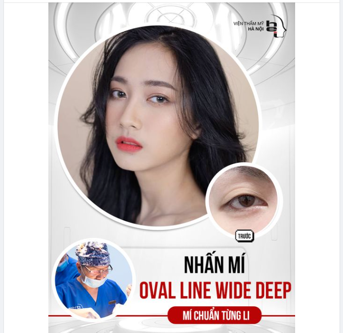 NHẤN MÍ OVAL LINE WIDE DEEP - Mí chuẩn từng li