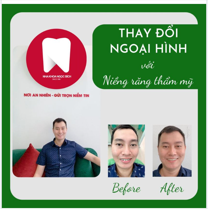 THÁO MẮC CÀI - ĐÓN TƯƠNG LAI
