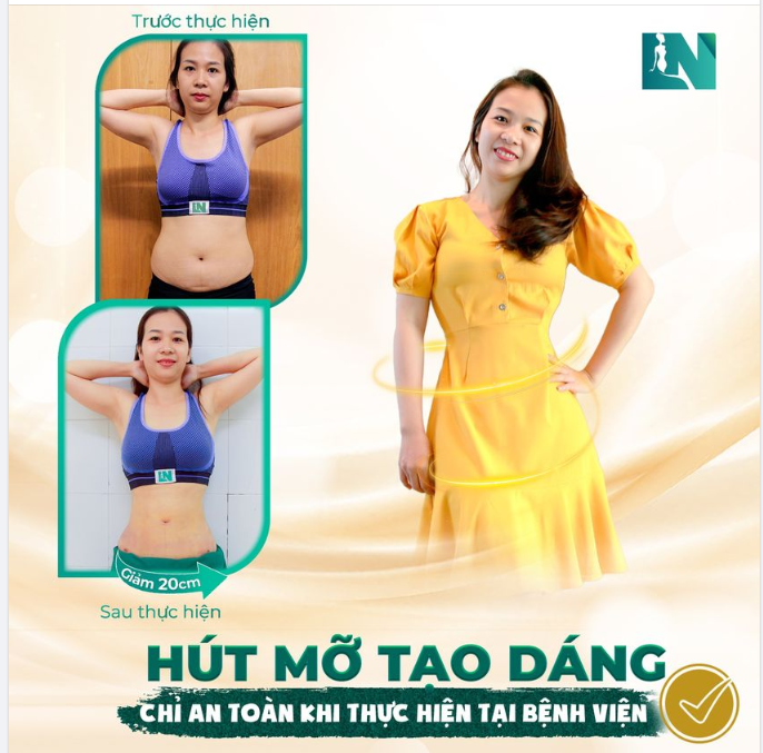 HÚT MỠ TẠO DÁNG CHỈ AN TOÀN KHI THỰC HIỆN TẠI BỆNH VIỆN