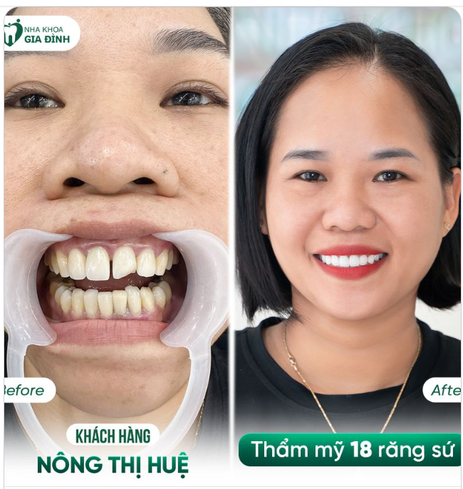 THAY ĐỔI NỤ CƯỜI - ĐIỂM 10 CHẤT LƯỢNG