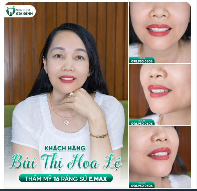 KHÔNG NGẠI THAY ĐỔI, GIỜ ĐÂY CHỊ ẤY ĐÃ CÓ NỤ CƯỜI MỸ MÃN