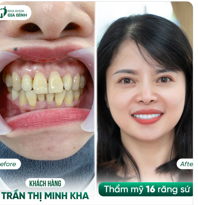 THAY ĐỔI ĐỂ TỰ TIN HƠN - THAY ĐỔI ĐỂ RẠNG RỠ HƠN