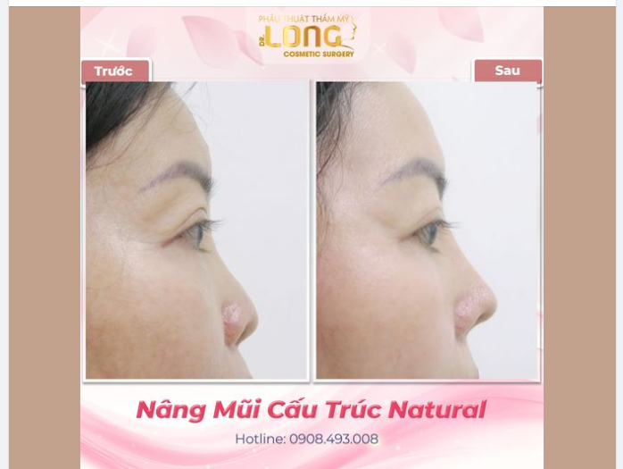 LÀM ĐẸP CHO BẢN THÂN CHƯA BAO GIỜ LÀ ĐẮT