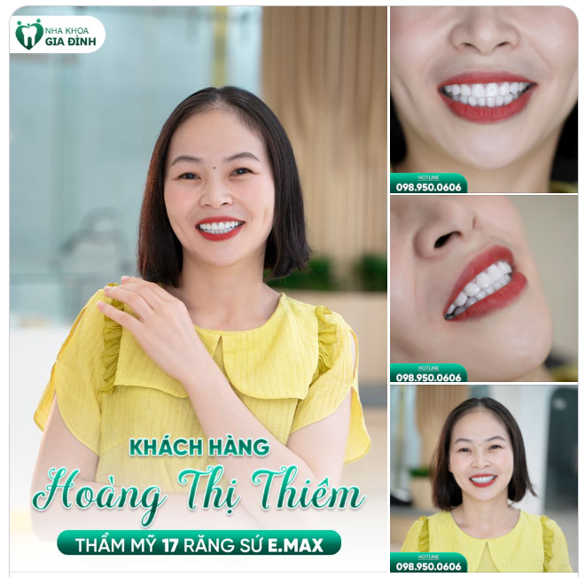 LÀ NGƯỜI THÍCH SỰ HOÀN MỸ, CHỊ GÁI CAO BẰNG QUYẾT TÂM XUỐNG HÀ NỘI THAY ĐỔI NỤ CƯỜI