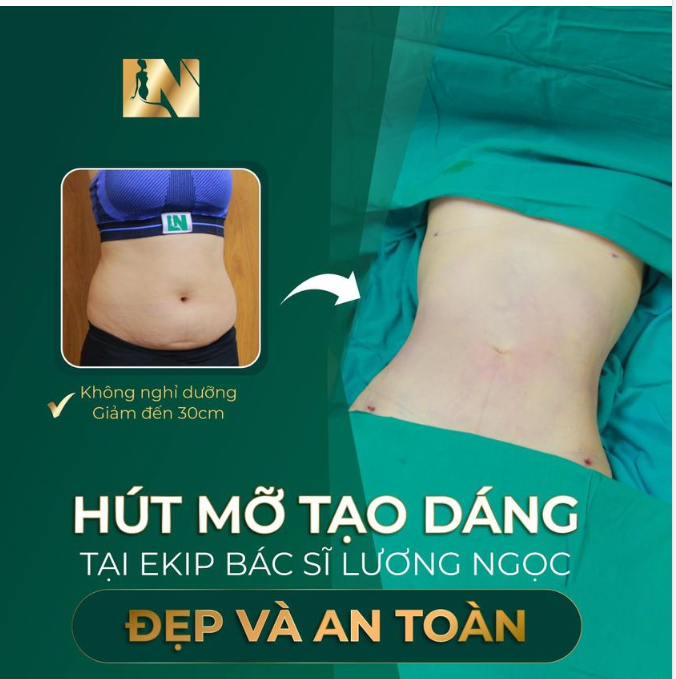 HÚT MỠ TẠO DÁNG - THĂNG HẠNG DÁNG VÓC