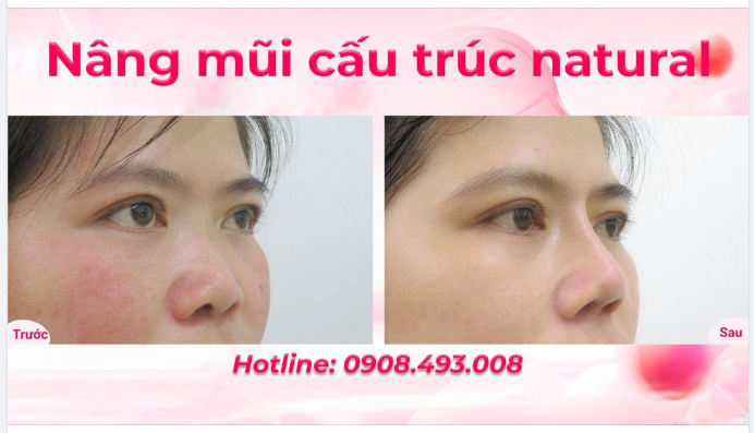 CHIA SẺ THẬT- TRẢI NGHIỆM THẬT- MŨI THẬT