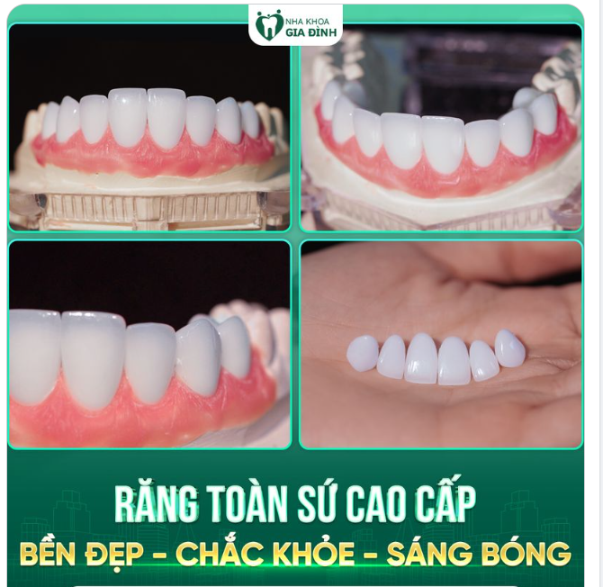RĂNG TOÀN SỨ CAO CẤP LÀM LÀ SANG - YÊN TÂM ĂN NHAI TỐT