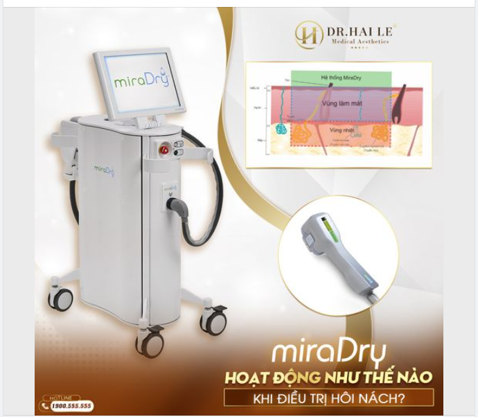 Với cơ chế hoạt động đặc biệt, miraDry đã giúp hàng ngàn khách hàng dứt điểm được tình trạng hôi nách. Vậy miraDry hoạt động như thế nào khi điều trị hôi nách?