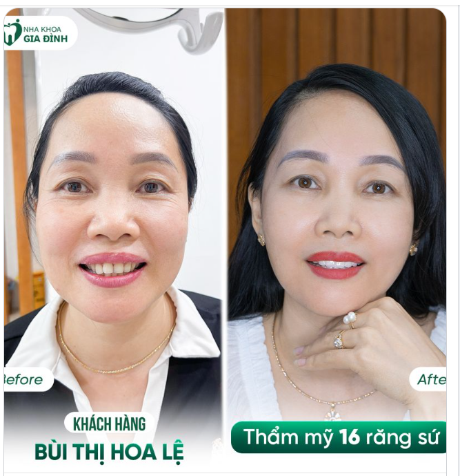 KHI ĐÃ QUYẾT ĐỊNH THAY ĐỔI THÌ KHÔNG GÌ CÓ THỂ LÀM KHÓ ĐƯỢC CHỊ
