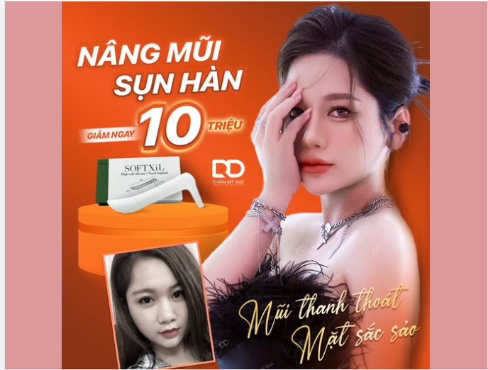 NÂNG MŨI SỤN HÀN, GIẢM NGAY 10TR