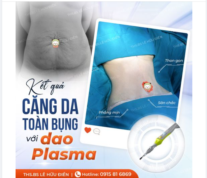 Tập gym ròng rã cả năm, không bằng 60 phút "độ" body tại BS Điền