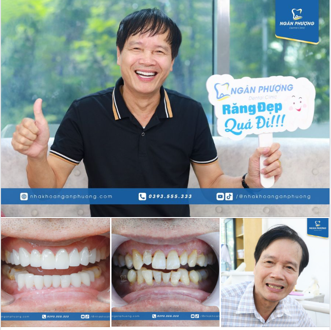 "50 năm rồi mới thấy bảnh như thế này" - Chú Trần Định thốt lên khi soi gương với nụ cười mới.