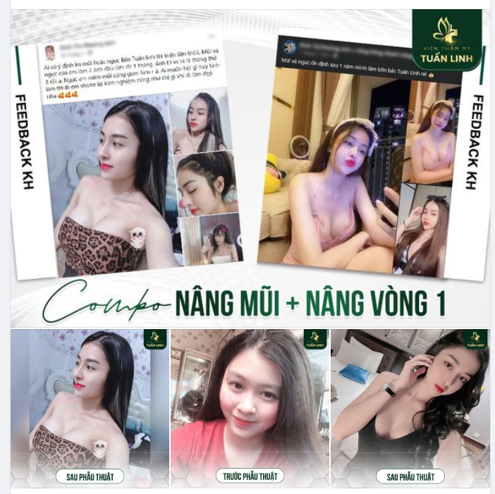 Làm đẹp COMBO - Lựa chọn thông minh - Giúp bạn đẹp toàn diện chỉ trong một lần phẫu thuật.