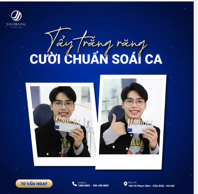 TẨY TRẮNG RĂNG CƯỜI CHUẨN SOÁI CA