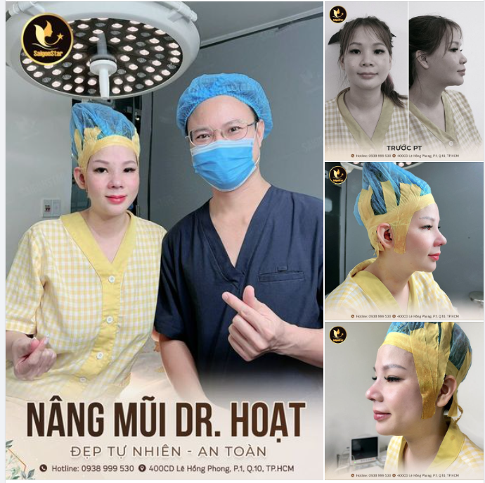 NÂNG MŨI DR. HOẠT  ĐẸP TỰ NHIÊN – AN TOÀN DÀI LÂU