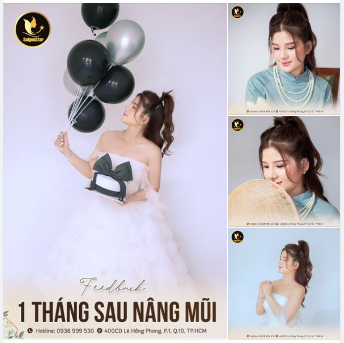 GÓC FEEDBACK Mỹ Ngân đẹp tựa “mỹ nhân” sau 1 tháng nâng mũi