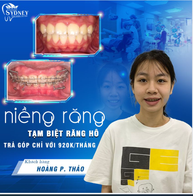 CÓ PHẢI RĂNG HÔ ĐANG LÀM BẠN TỰ TI?